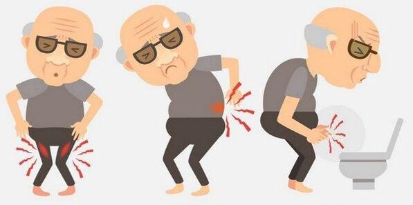 Prostatite symptoms