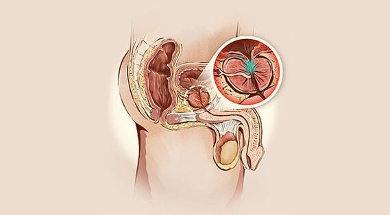 Prostate